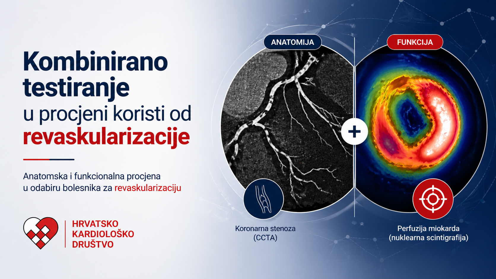 Kombinacija anatomskog i funkcionalnog testiranja u procjeni koristi od revaskularizacije stabilne koronarne bolesti